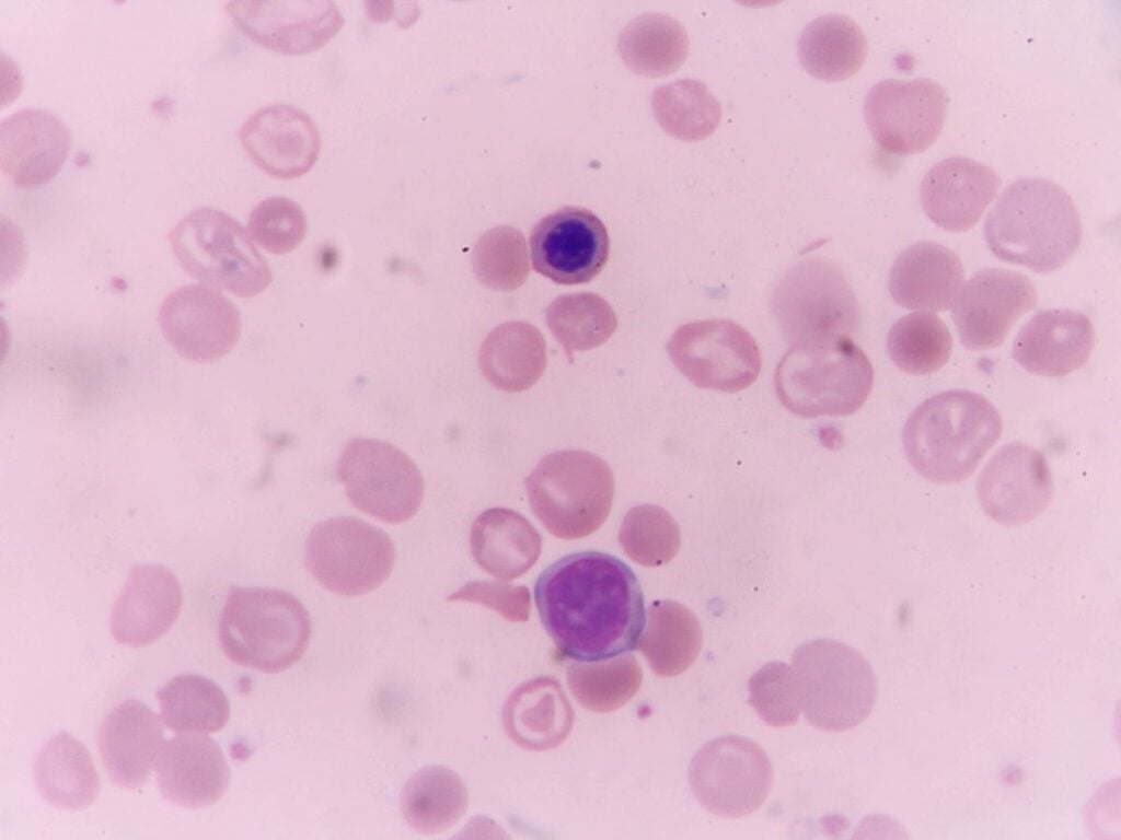 Cyclospora