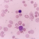 Cyclospora