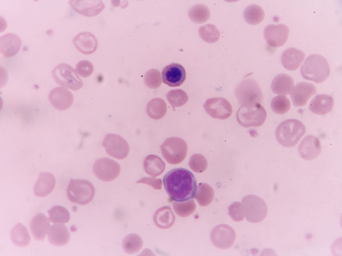 Cyclospora